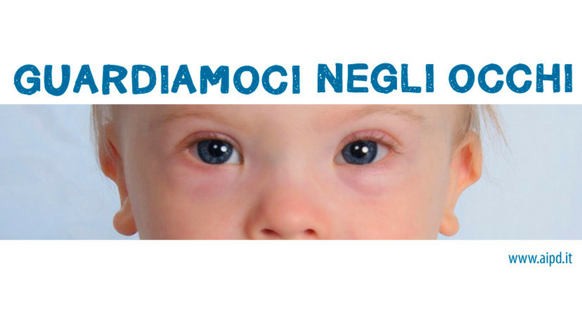 immagine di bambino con sindrome di down